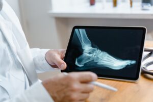 Cómo la AI y la tecnologia está redefiniendo la radiología médica Cómo la AI y la tecnologia está redefiniendo la radiología médica